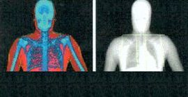 Body composition Body composition