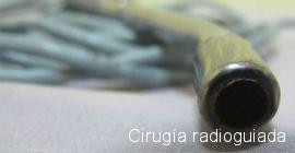 Cirugía radioguiada